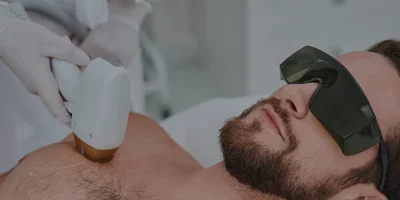 cover-laser-apotrixosi-man